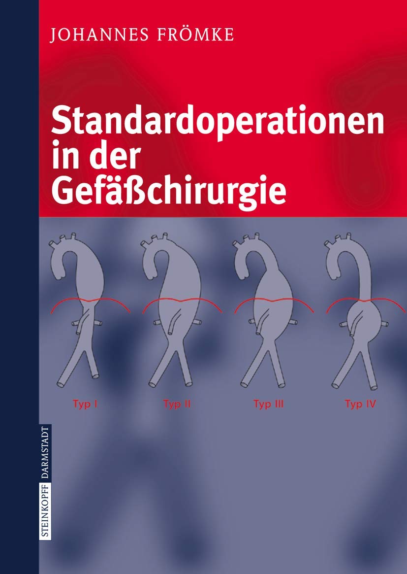 Standardoperationen in der Gefäßchirurgie Medicine