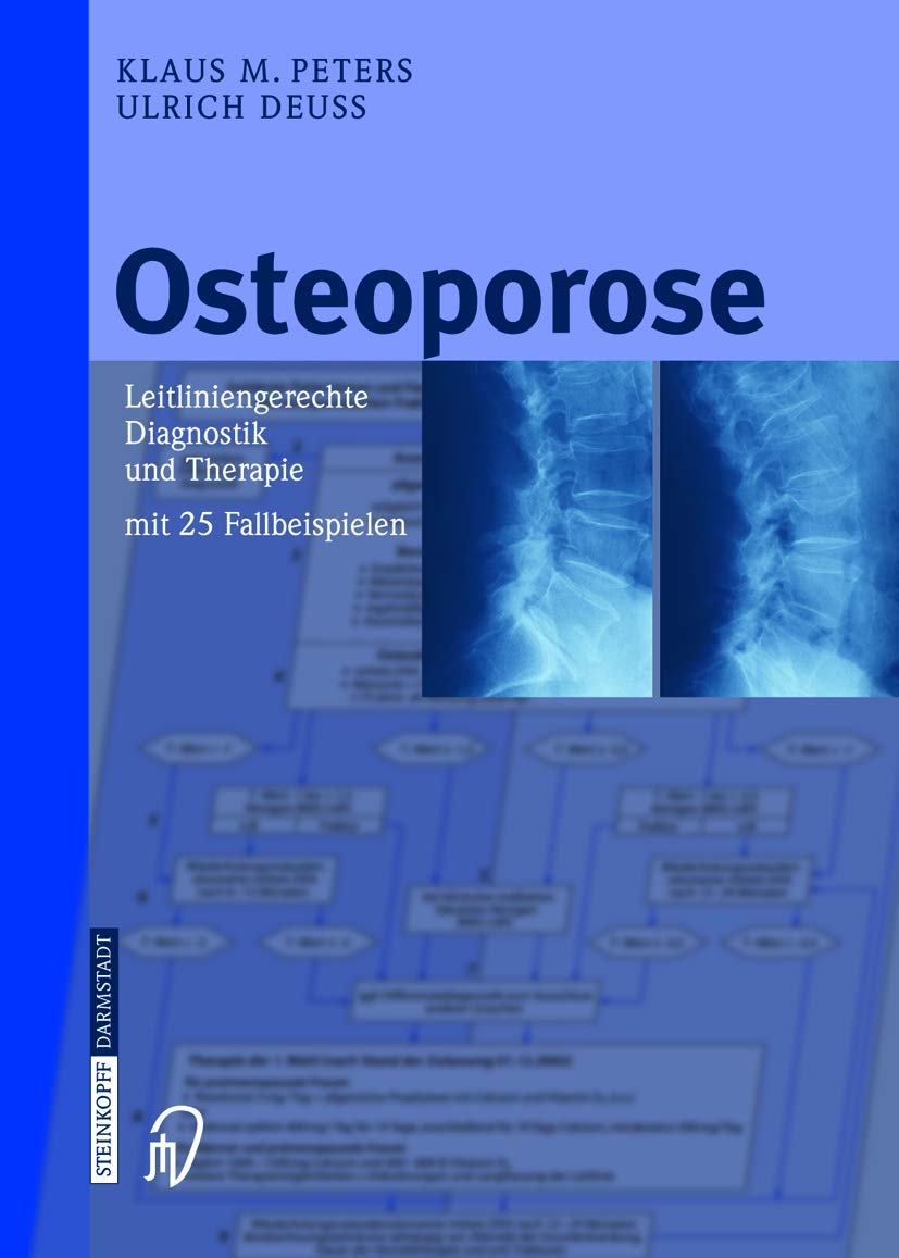 Product Image: Osteoporose