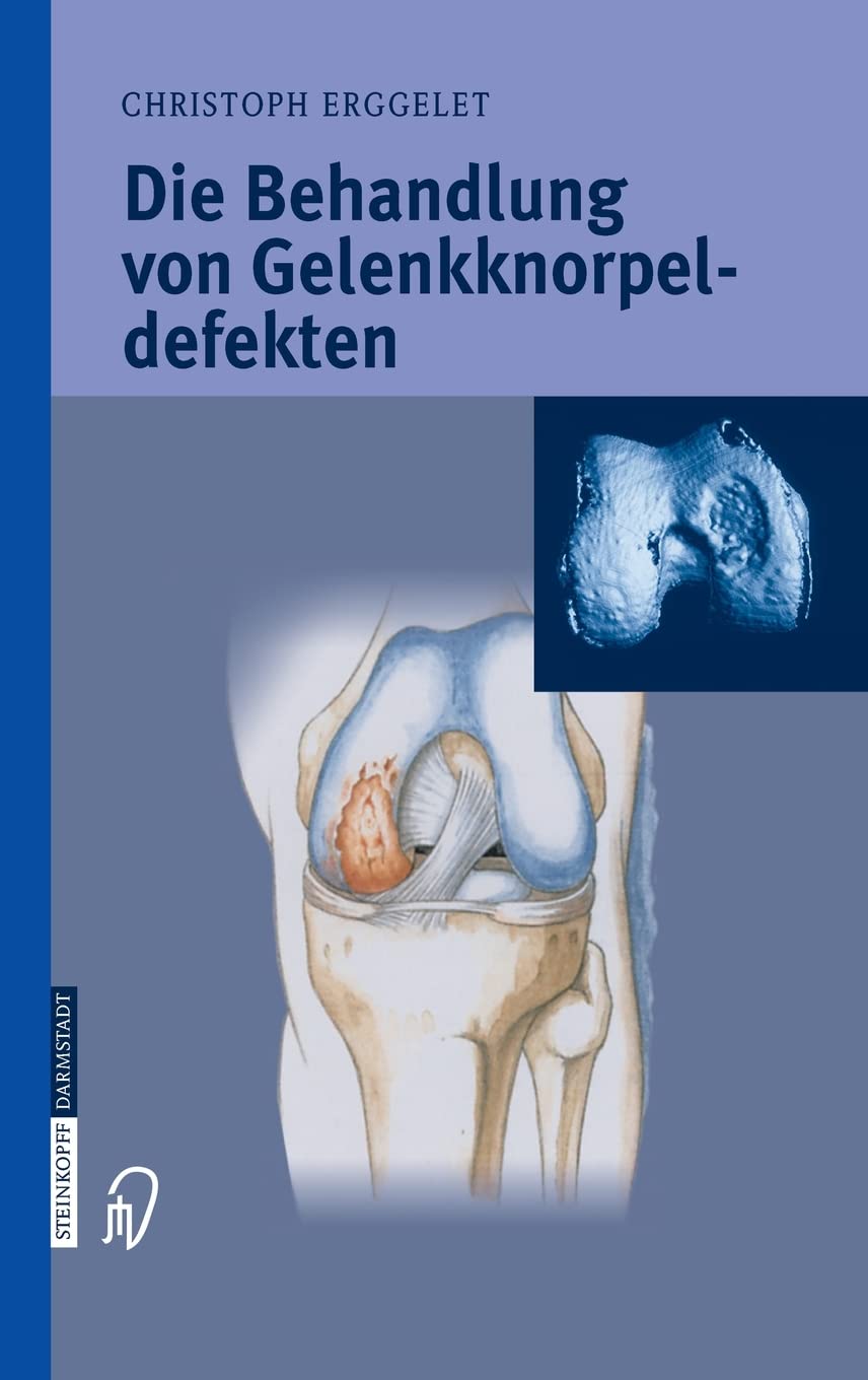 Die Behandlung Von Gelenkknorpeldefekten book