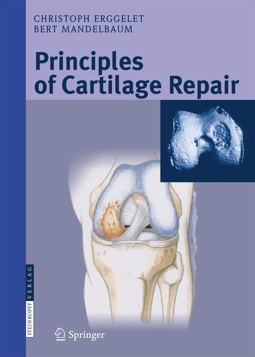 Principles of Cartilage Repair Medicine
