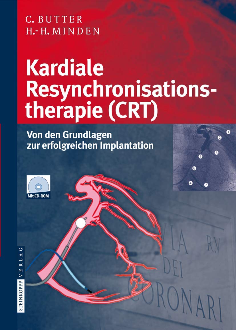 Kardiale Resynchronisationstherapie (CRT): Von den Grundlagen zur erfolgreichen Implantation Medicine