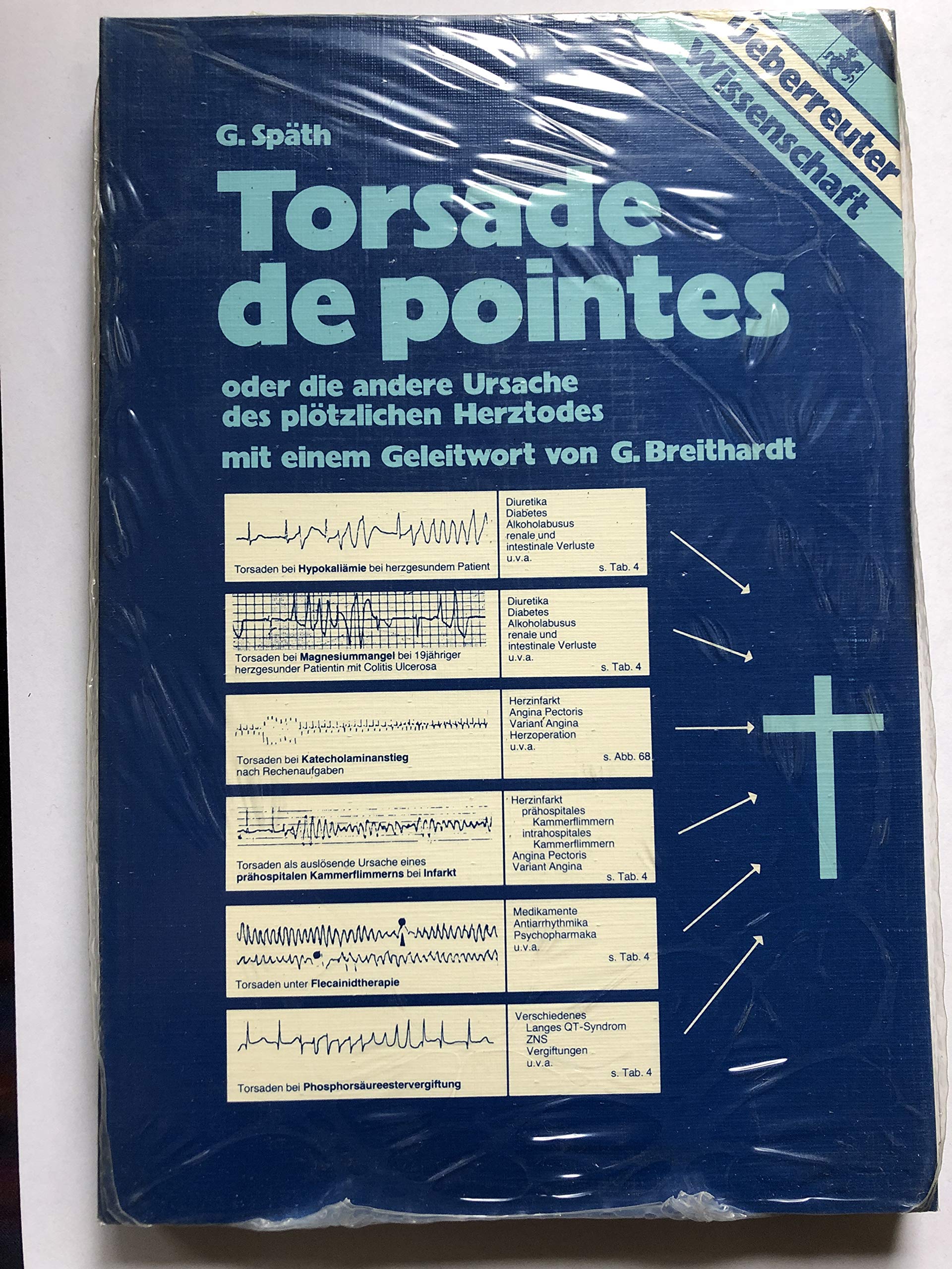 Torsade de pointes oder die andere Ursache des plötzlichen Herztodes. Mit Geleitwort von G. Breithardt. Books