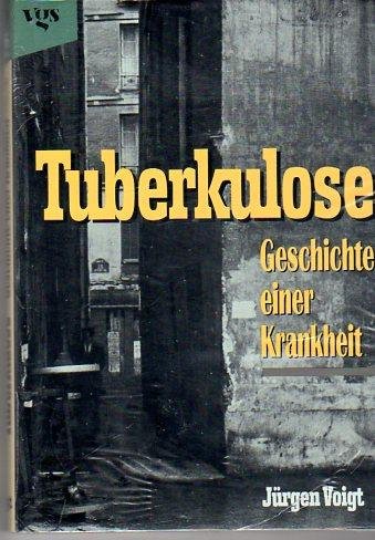 Tuberkulose. Geschichte einer Krankheit Medicine