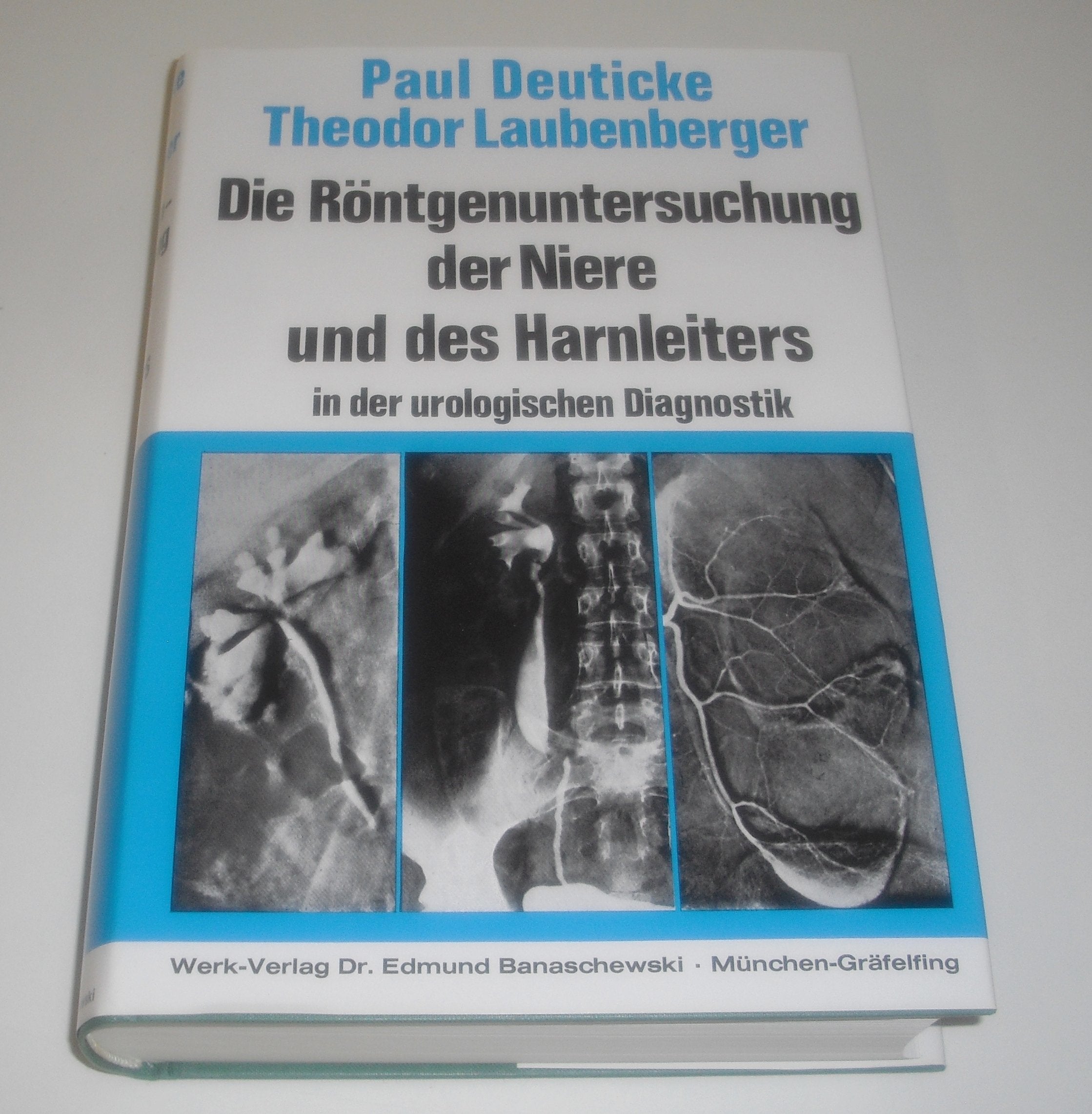 Die Röntgenuntersuchung der Niere und des Harnleiters in der urologischen Diagnostik Medicine