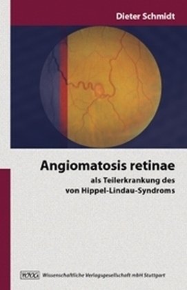 Angiomatosis retinae: als Teilerkrankung des von Hippel-Lindau-Syndroms Medicine
