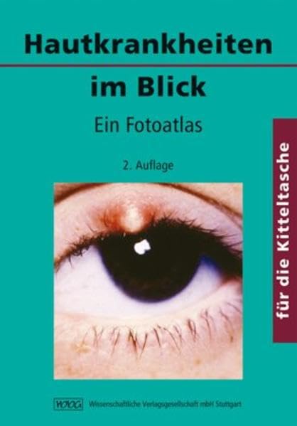Hautkrankheiten im Blick: Ein Fotoatlas für die Kitteltasche Medicine