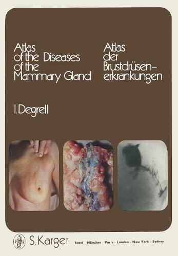 Atlas of the Diseases of the Mammary Gland / Atlas der Brustdrüsenerkrankungen Medicine