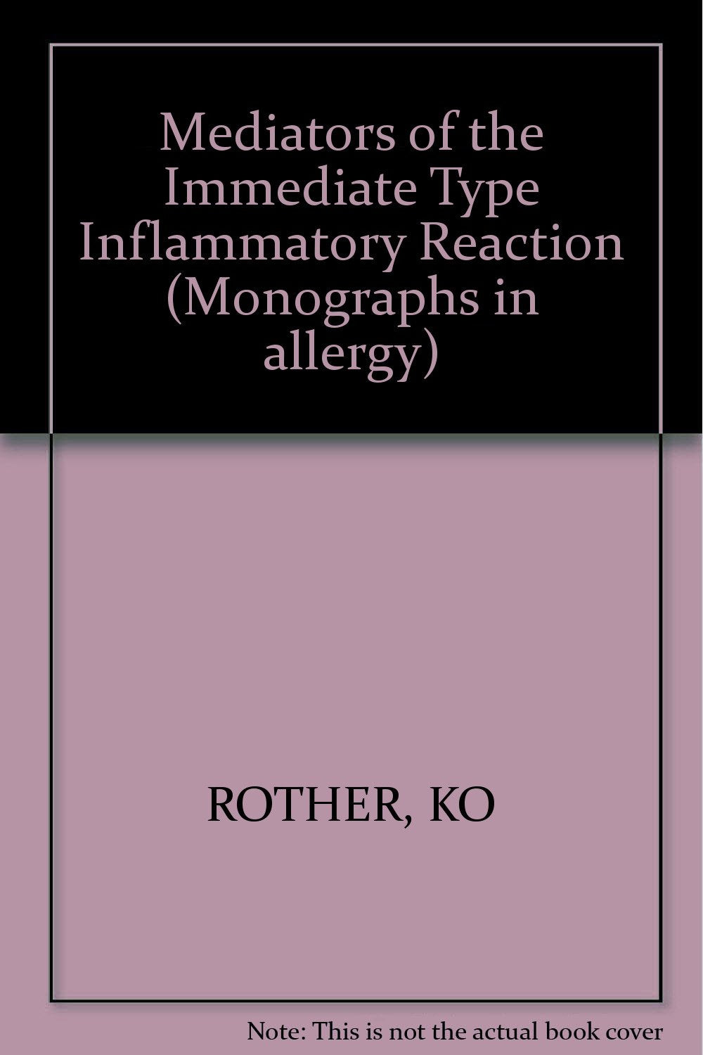 Monographs in Allergy / Mediators of the Immediate Type Inflammatory Reaction: 11th Symposium of the Collegium Internationale Allergologicum, ... May 1976 (Monographs in Allergy, 12, Band 12) Medicine