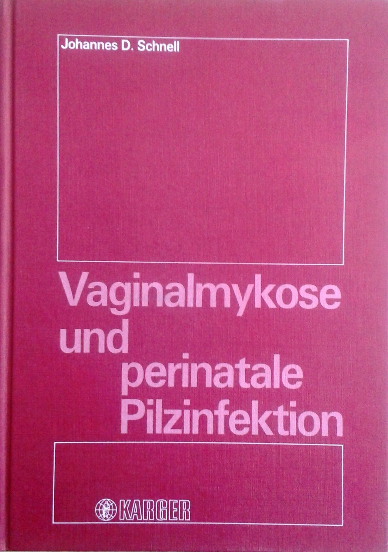 Vaginalmykose und perinatale Pilzinfektion Medicine