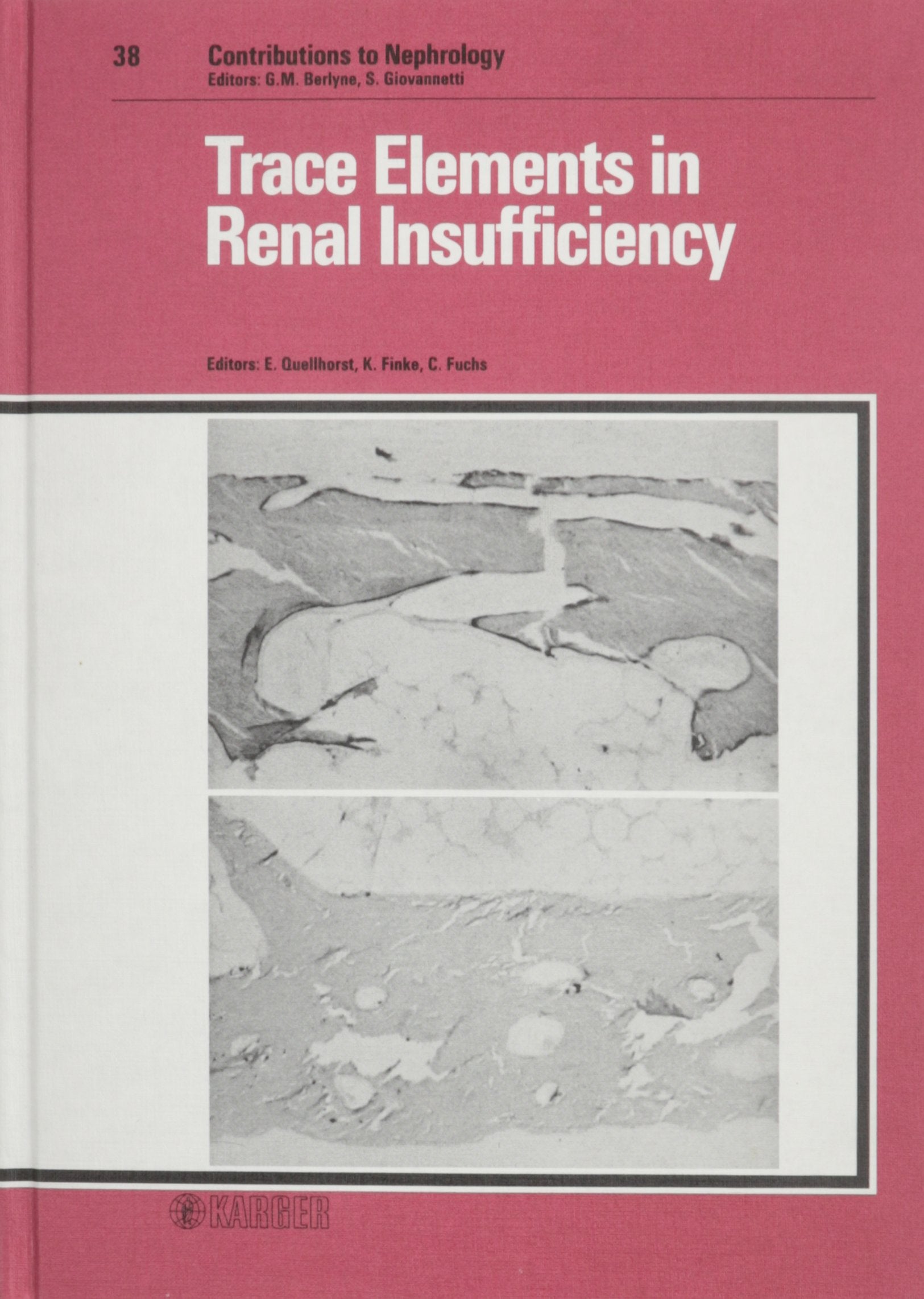 Contributions to Nephrology / Trace Elements in Renal Insufficiency: Symposium, Bernried, March 1983 Medicine