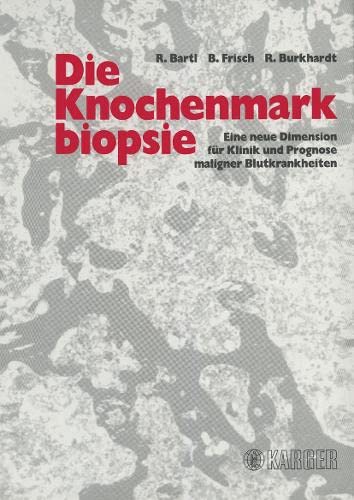 Die Knochenmarkbiopsie: Eine neue Dimension für Klinik und Prognose maligner Blutkrankheiten.: Eine neue Dimension f. Klinik u. Prognose maligner Blutkrankheiten Medicine