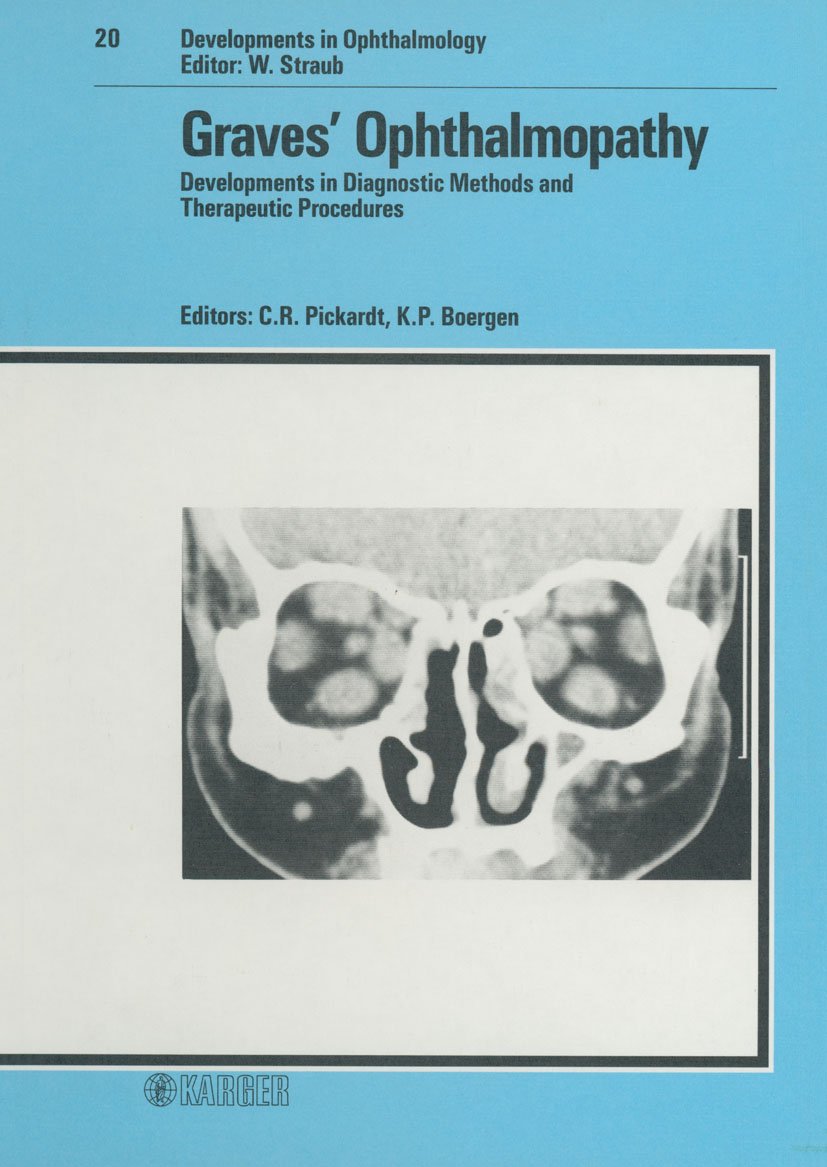 Developments in Ophthalmology / Graves' Ophthalmopathy: International Workshop on Graves' Ophthalmopathy, Homburg/Saar, October 1987.: Developments in ... Workshop, Homburg/Saar, October 1987 Medicine