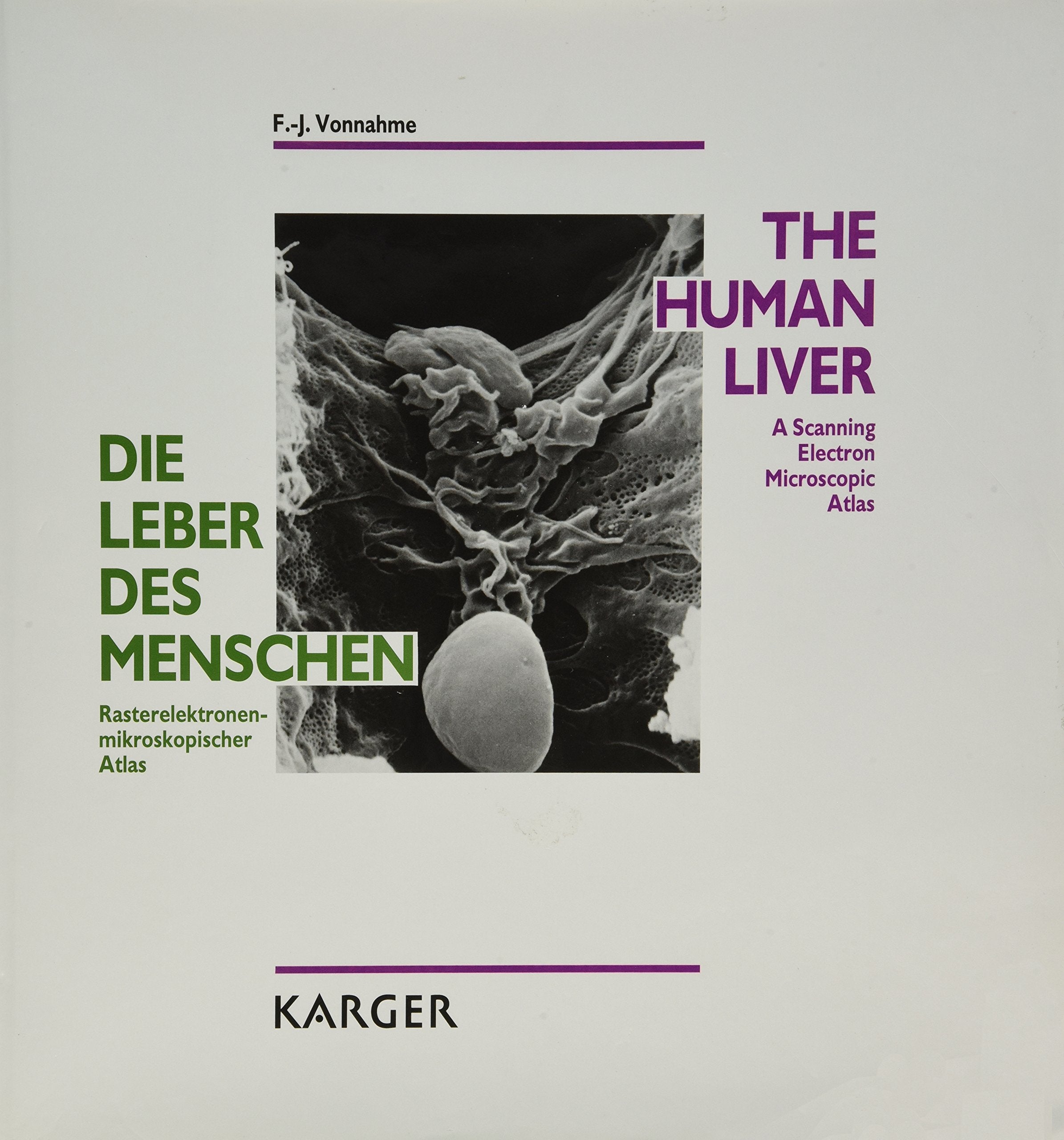 Die Leber des Menschen /The Human Liver: Rasterelektronenmikroskopischer Atlas /A Scanning Electron Microscopic Atlas.: Rasterelektronenmikroskopischer Atlas. Dtsch.-Engl. Medicine