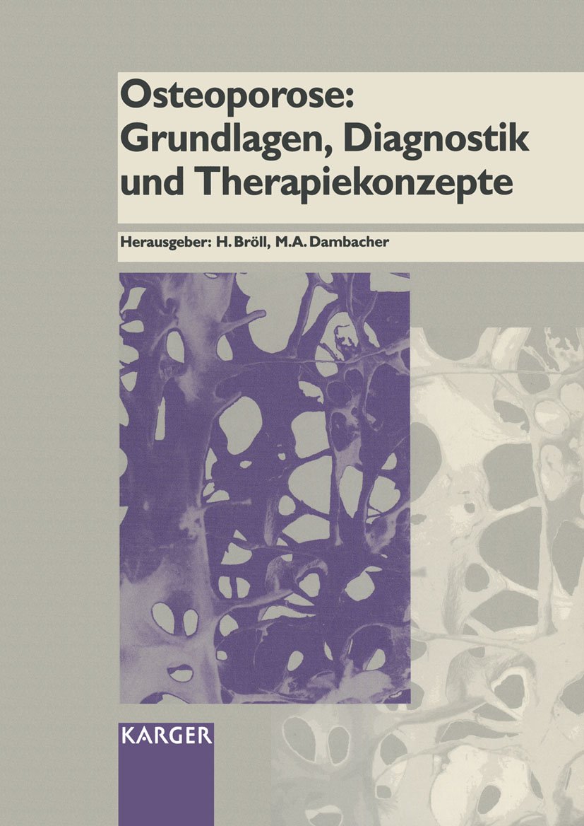 Osteoporose: Grundlagen, Diagnostik und Therapiekonzepte Medicine