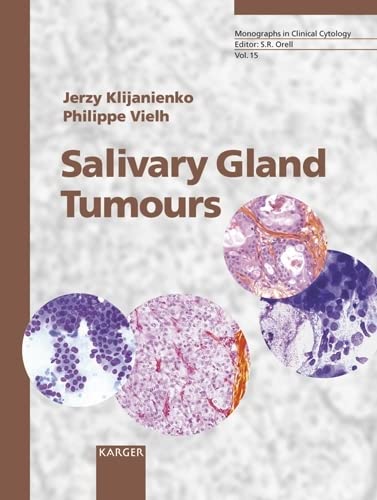 Salivary Gland Tumours: Monographs in Clinical Cytology book