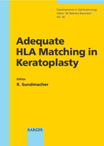 Adequate HLA Matching in Keratoplasty: 'Developments in Ophthalmology', Vol. 36. Medicine