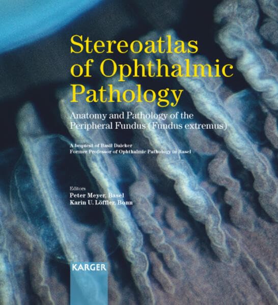 Stereoatlas of Ophthalmic Pathology: Anatomy and Pathology of the Peripheral Fundus (Fundus extremus). A bequest of Basil Daicker, former Professor of ... Basel. Includes stereo glasses and a CD-ROM Medicine