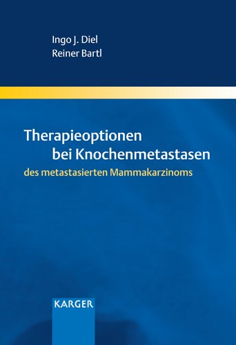 Therapieoptionen bei Knochenmetastasen des metastasierten Mammakarzinoms Medicine