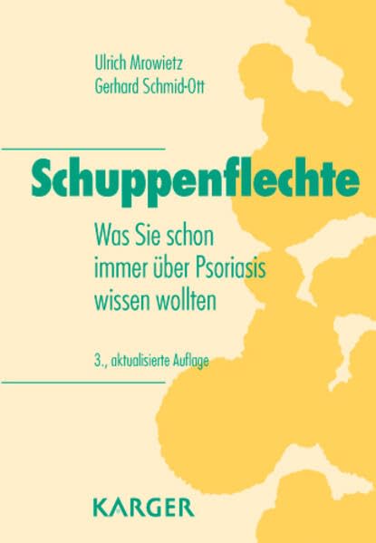 Schuppenflechte: Was Sie schon immer über Psoriasis wissen wollten Medicine