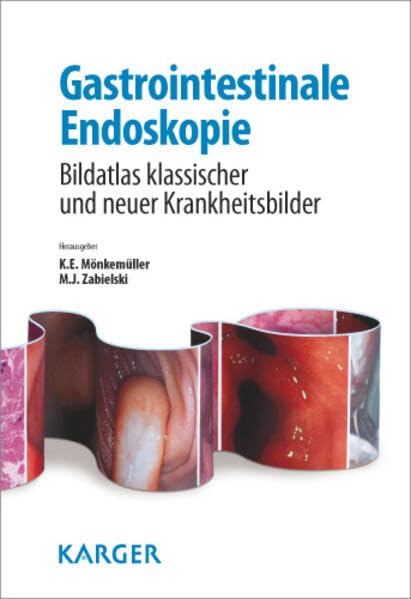 Gastrointestinale Endoskopie: Bildatlas klassischer und neuer Krankheitsbilder Medicine