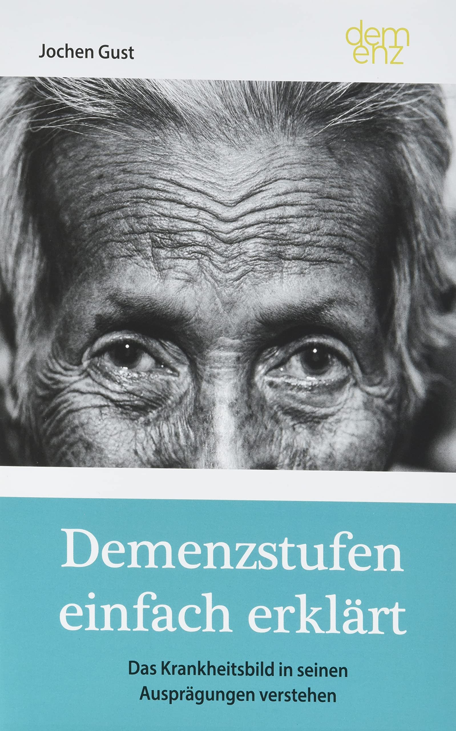 Demenzstufen einfach erklärt: Das Krankheitsbild in seinen Ausprägungen verstehen Medicine
