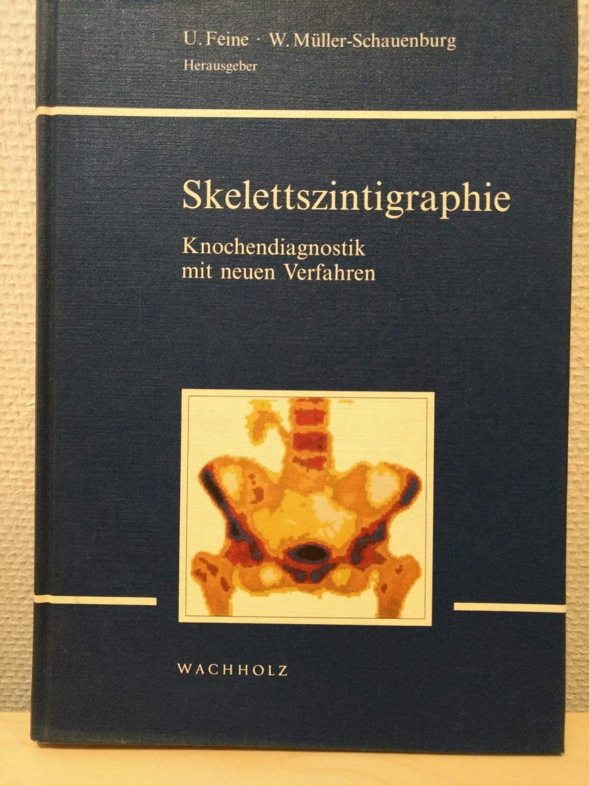 Skelettszintigraphie: Knochendiagnostik mit neuen Verfahren Medicine
