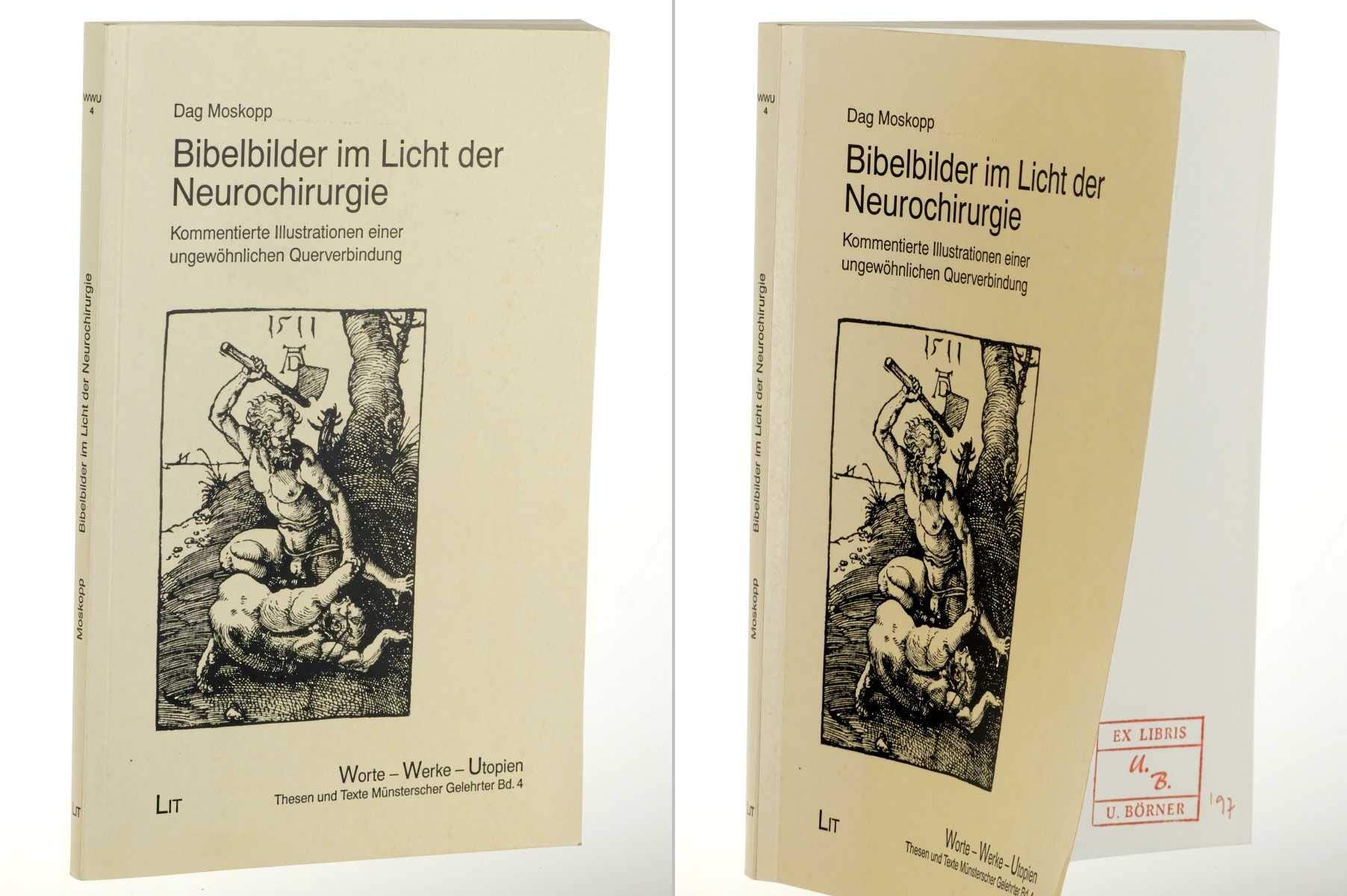Bibelbilder im Licht der Neurochirurgie: Kommentierte Illustrationen einer ungewöhnlichen Querverbindung Religion & Esotericism