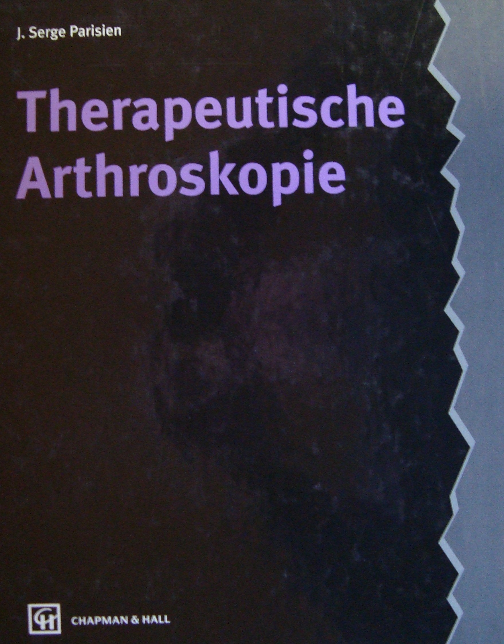 Therapeutische Arthroskopie Books
