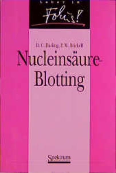 Product Image: Nucleinsäure-Blotting
