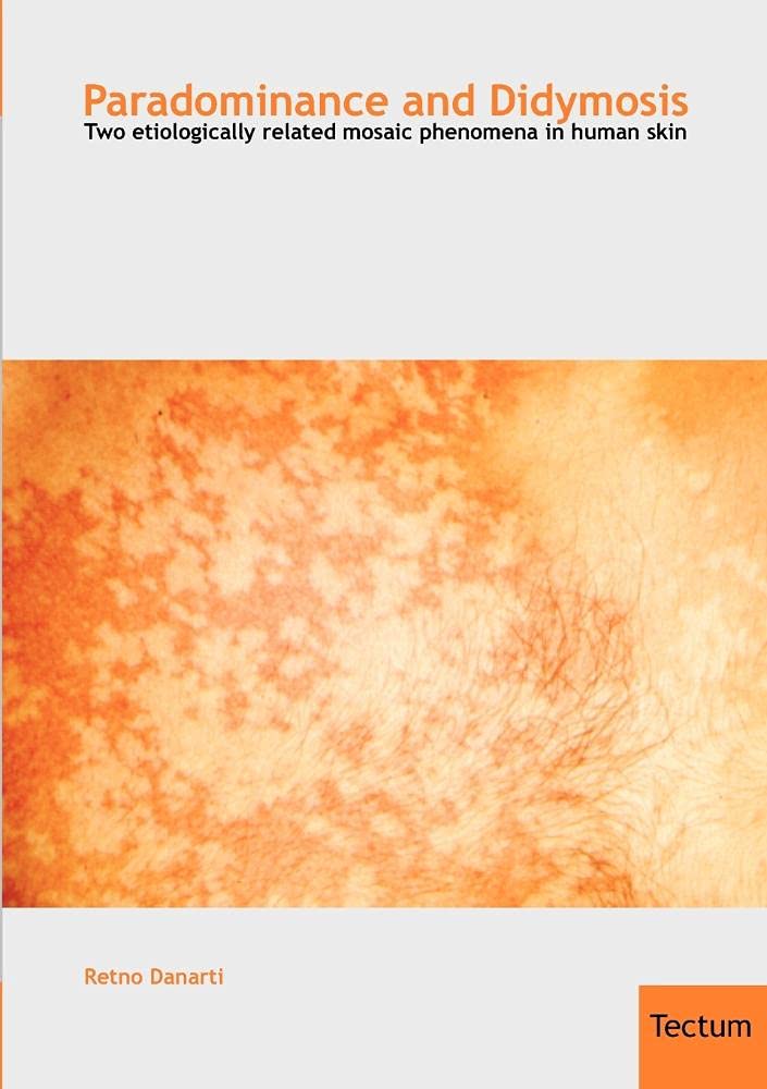 Paradominance and Didymosis: Two etiologically related mosaic phenomena in human skin Medicine