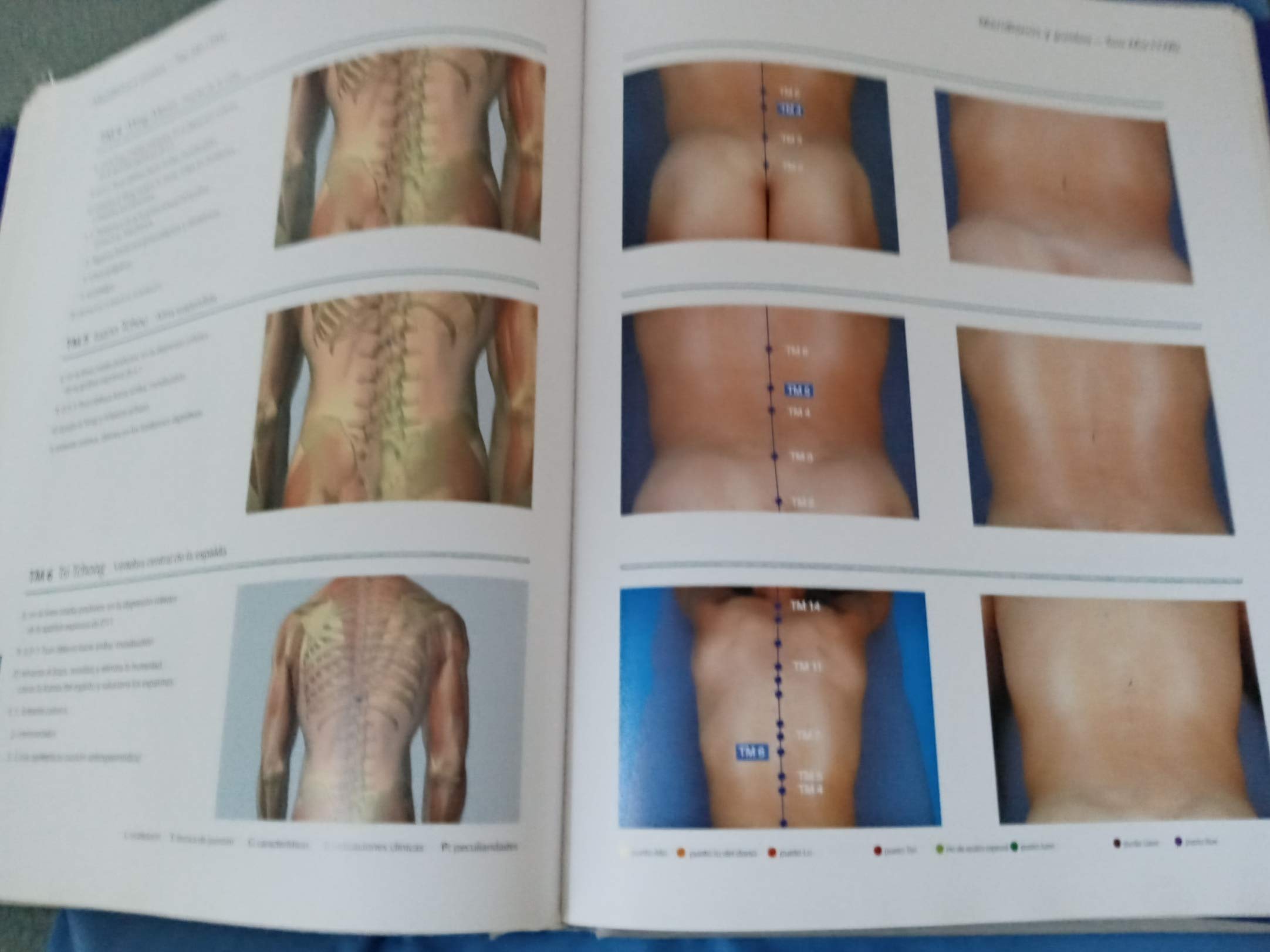 Atlas Seirin De Acupunctura Health, Nutrition & Fitness