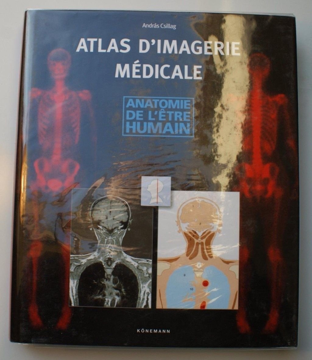 Atlas d'imagerie médicale : Anatomie de l'être humain Reference Books