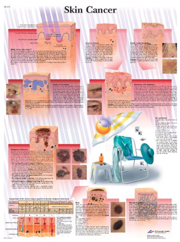 Anatomische Lehrtafel: Skin Cancer Medicine