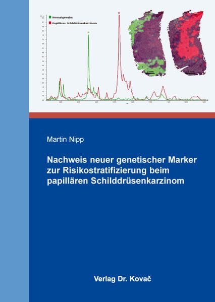 Nachweis neuer genetischer Marker zur Risikostratifizierung beim papillären Schilddrüsenkarzinom (Schriftenreihe Naturwissenschaftliche Forschungsergebnisse) Natural Sciences