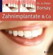 Zahnimplantate & Co.. Die Implantologie in der modernen Zahnheilkunde Books