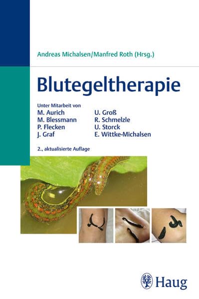 Product Image: Blutegeltherapie