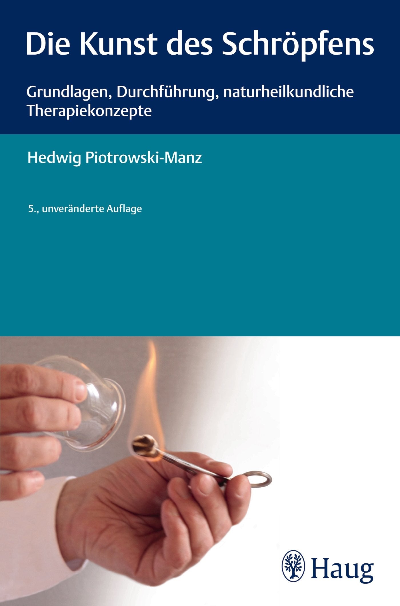 Die Kunst des Schröpfens: Grundlagen, Durchführung, naturheilkundliche Therapiekonzepte Medicine
