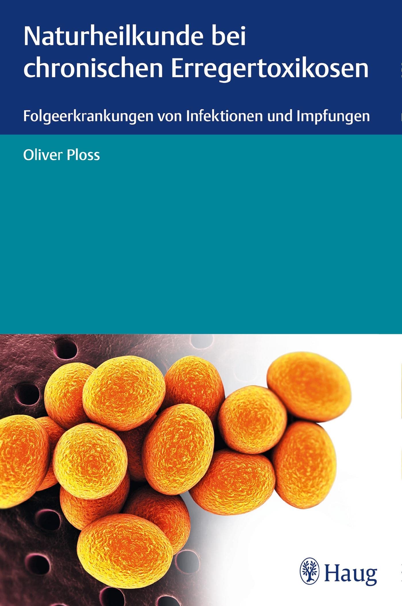 Naturheilkunde bei chronischen Erregertoxikosen Medicine