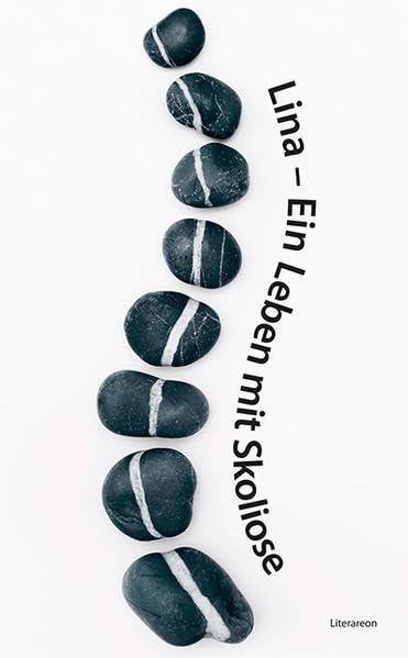 Ein Leben mit Skoliose (Literareon) Books