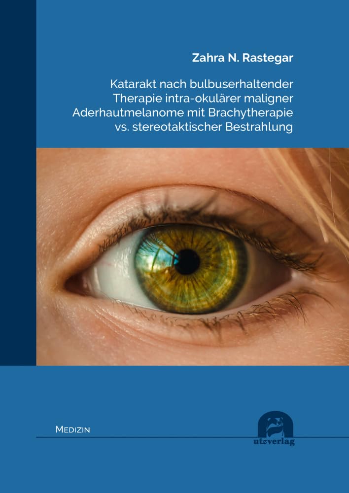 Katarakt nach bulbuserhaltender Therapie intra-okulärer maligner Aderhautmelanome mit Brachytherapie vs. stereotaktischer Bestrahlung (Medizin) Medicine