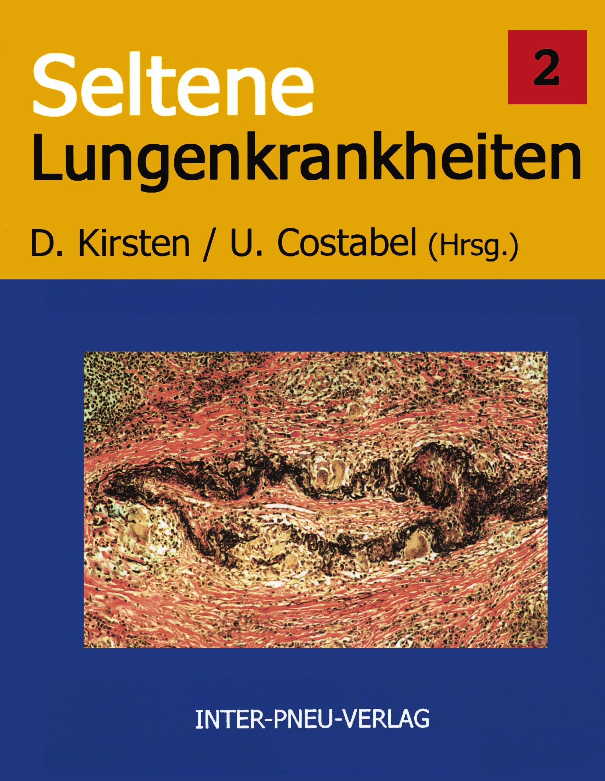 Seltene Lungenkrankheiten. Band 2 Medicine