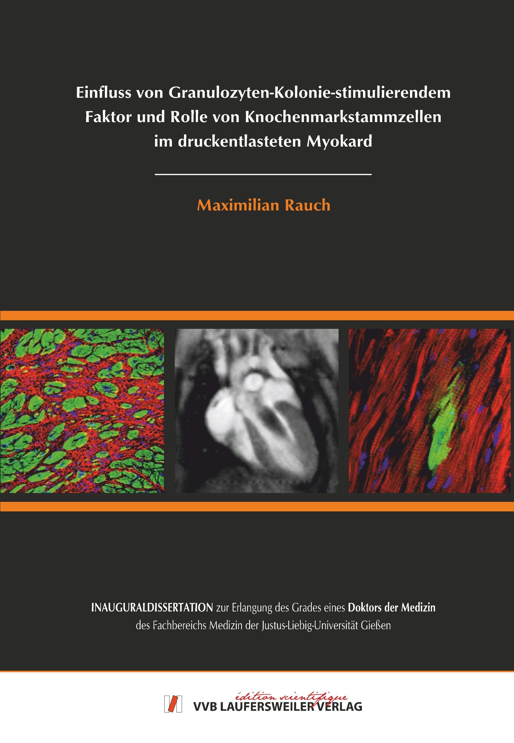 Einfluss von Granulozyten-Kolonie-stimulierendem Faktor und Rolle von Knochenmarkstammzellen im druckentlasteten Myokard Medicine