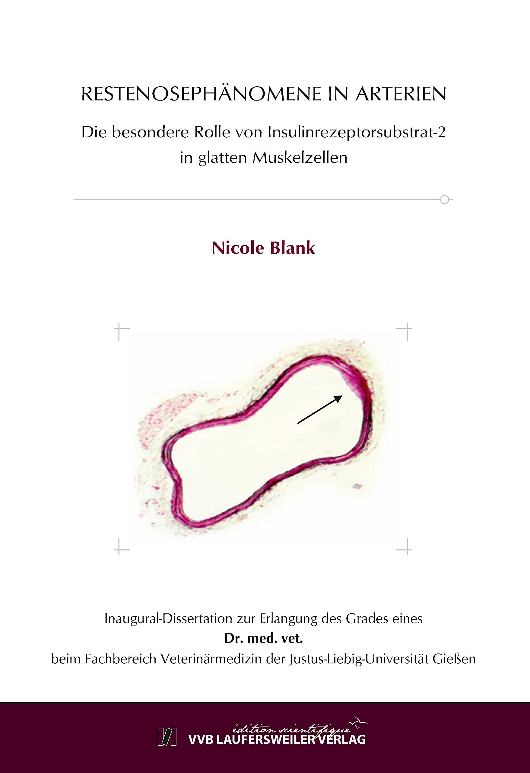 RESTENOSEPHÄNOMENE IN ARTERIEN: DIE BESONDERE ROLLE VON INSULINREZEPTORSUBSTRAT-2IN GLATTEN MUSKELZELLEN (Edition Scientifique) Medicine