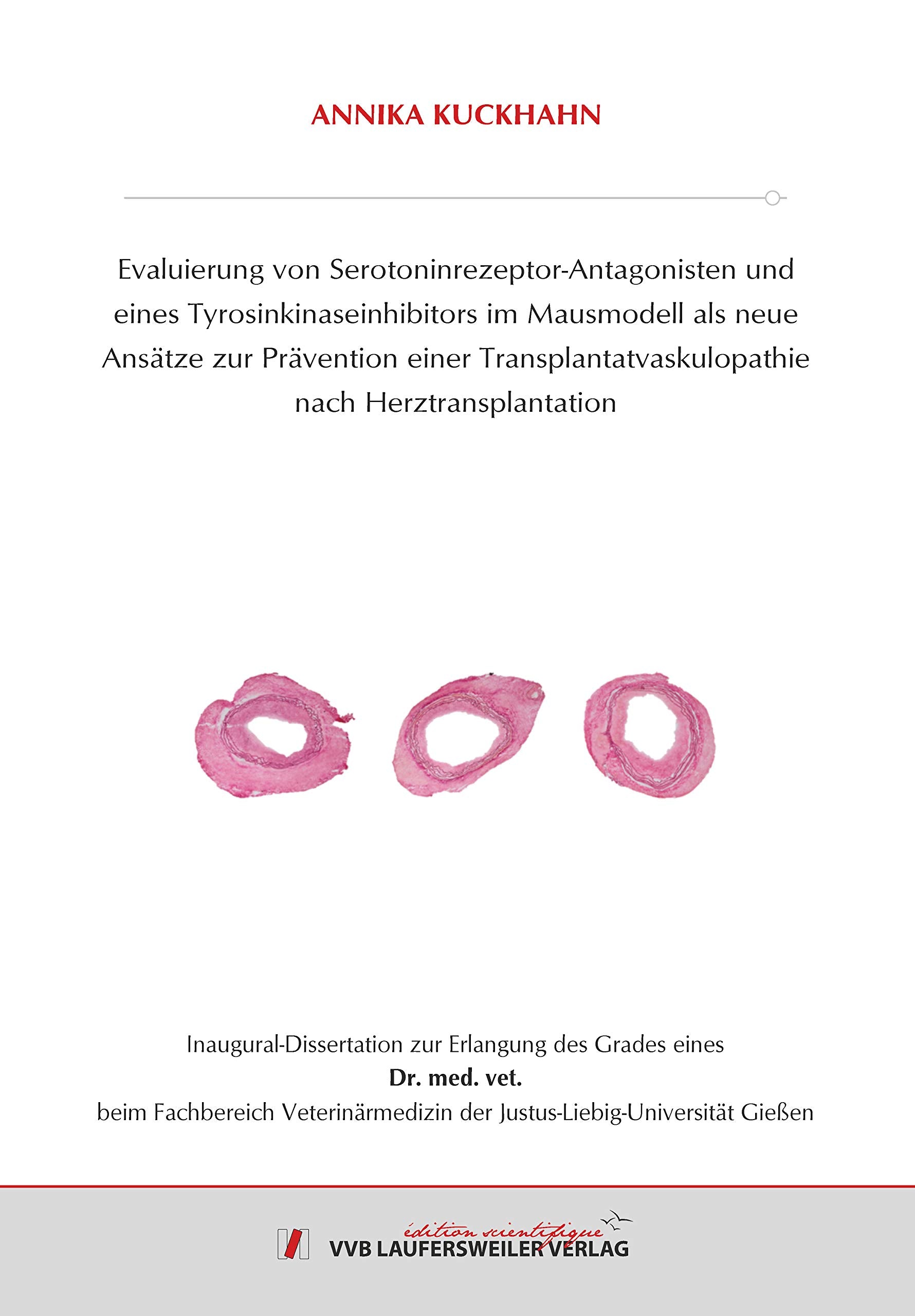 Evaluierung von Serotoninrezeptor-Antagonisten und eines Tyrosinkinaseinhibitors im Mausmodell als neue Ansätze zur Prävention einer ... Herztransplantation (Edition Scientifique) Medicine