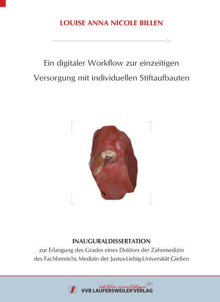 Ein digitaler Workflow zur einzeitigen Versorgung mit individuellen Stiftaufbauten (Edition Scientifique) Medicine