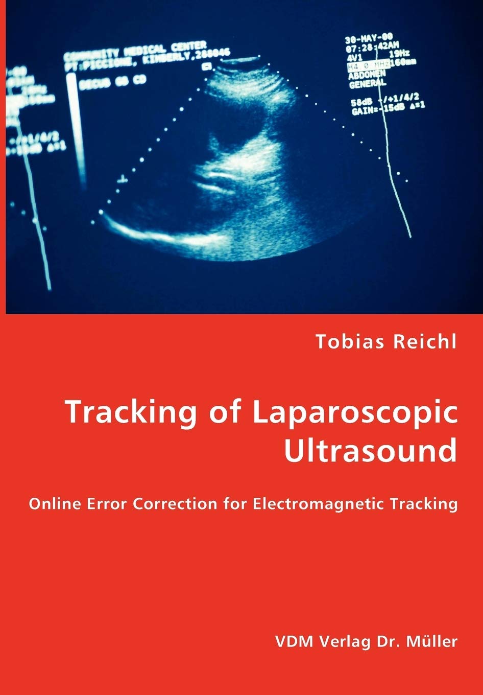 Tracking of Laparoscopic Ultrasound: Online Error Correction for Electromagnetic Tracking Medicine
