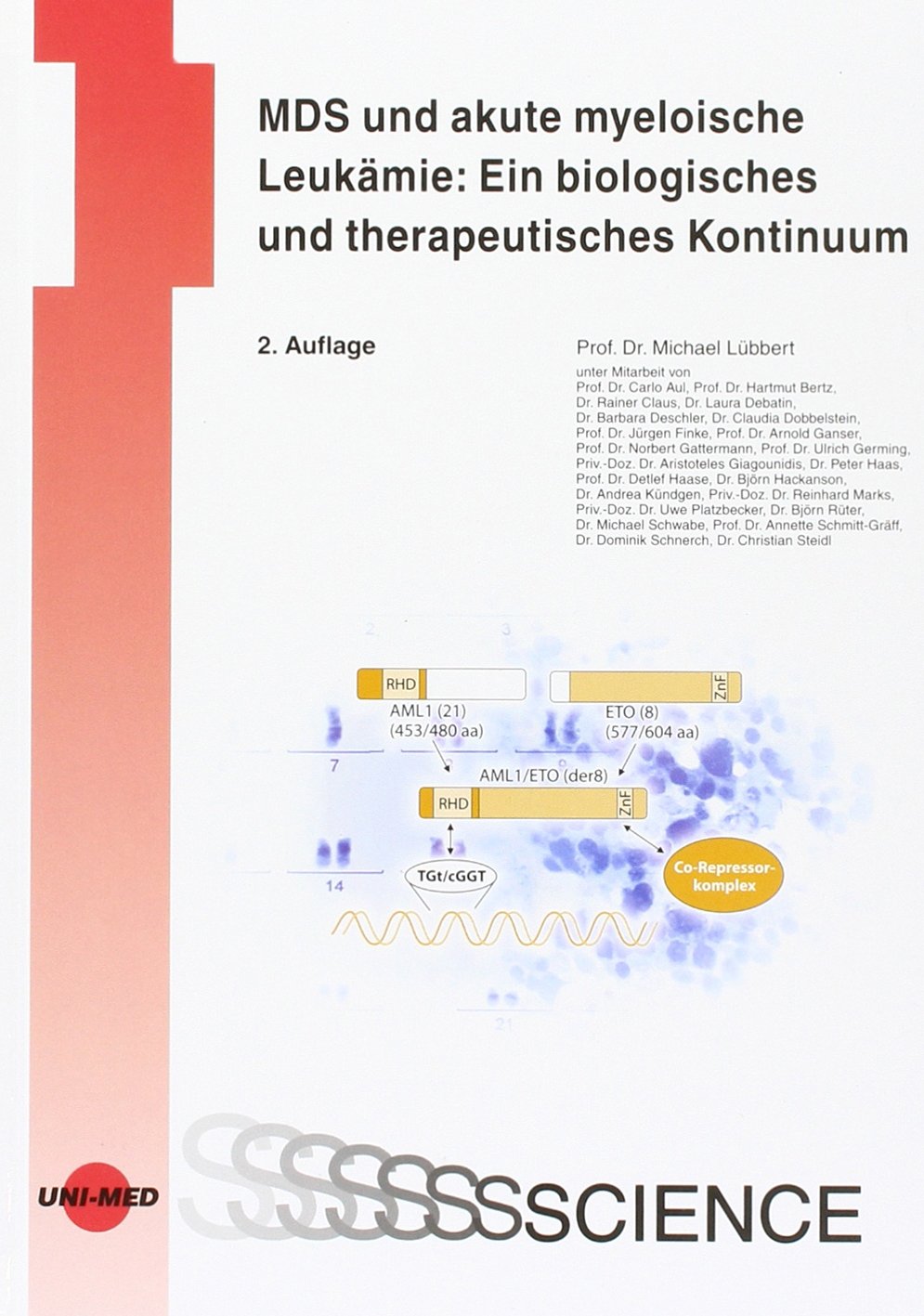 MDS und akute myeloische Leukämie: Ein biologisches und therapeutisches Kontinuum Medicine