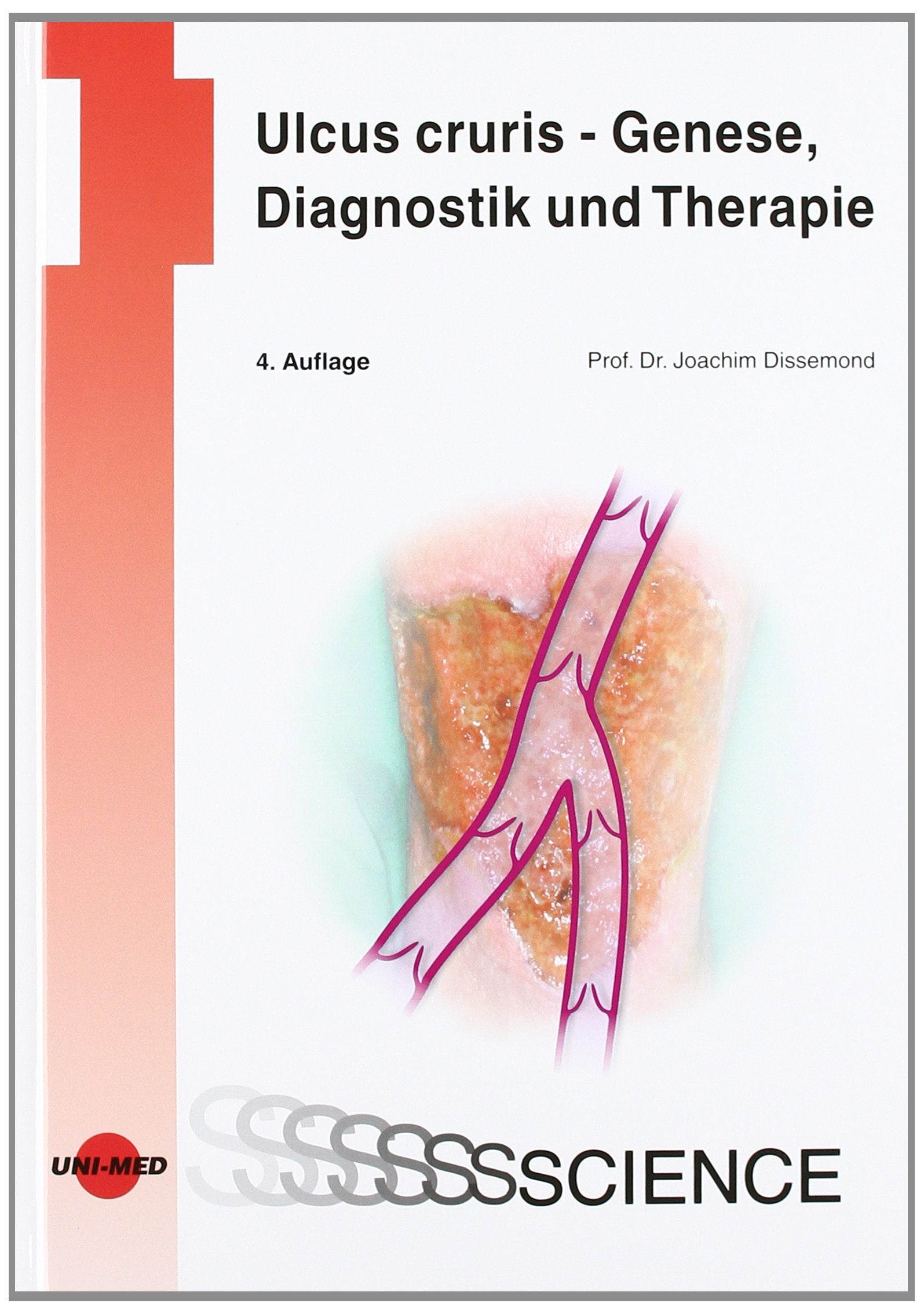 Ulcus cruris - Genese, Diagnostik und Therapie Medicine