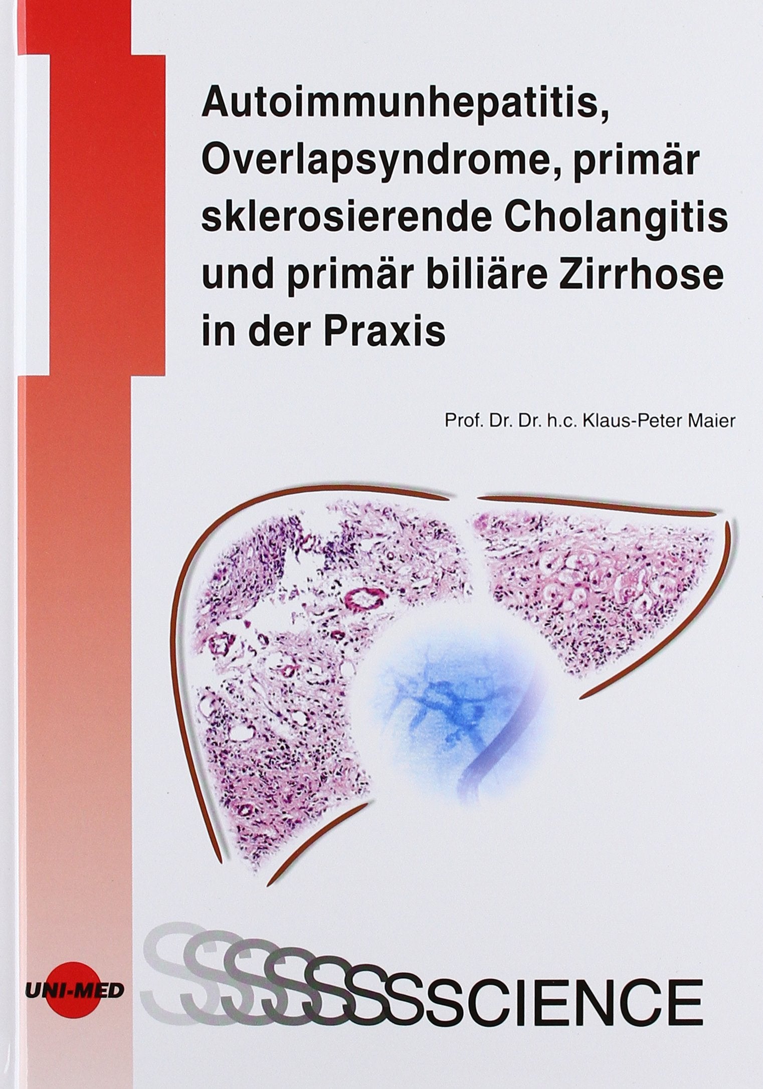 Autoimmunhepatitis, Overlapsyndrome, primär sklerosierende Cholangitis und primär biliäre Zirrhose in der Praxis Medicine