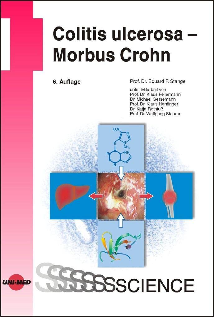 Colitis ulcerosa - Morbus Crohn (UNI-MED Science) Medicine